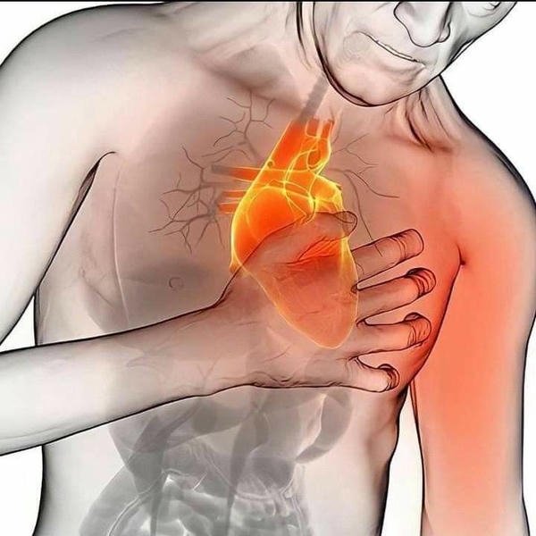 Biểu cảm đau tim dạng ảnh meme vui nhộn ghê